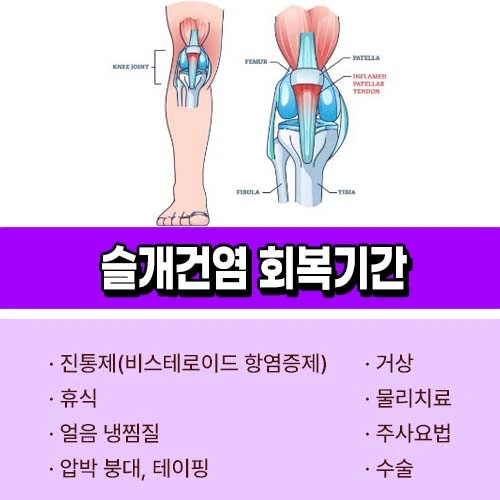 슬개건염 회복기간