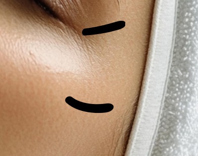 얼굴이 가려운 이유