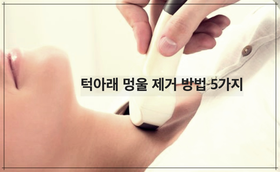 턱아래 멍울 제거 방법 5가지