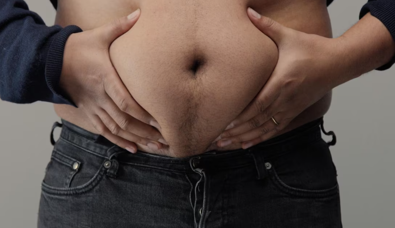 고도비만의 유전적 요인