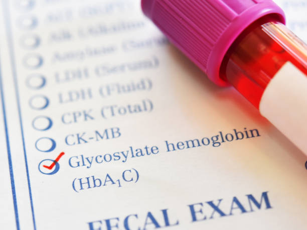 당화혈색소 정상수치 낮추는 방법