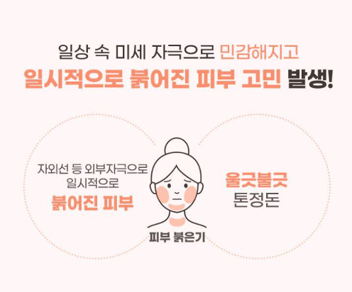 에스트라 더마UV365 레드진정 톤업 선크림 리뷰