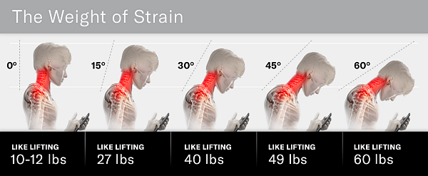 목 삐끗 했을때 경추염좌 맞춤형 치료 종류, 상해등급