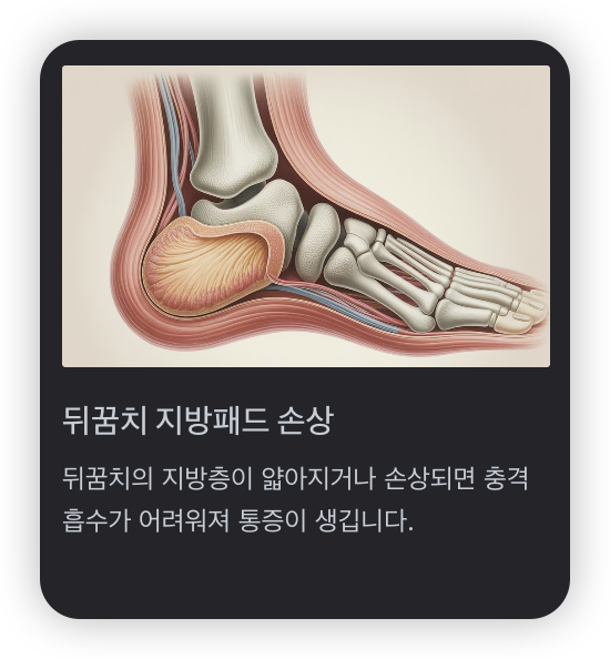 발바닥-통증-부위-뒤꿈치-지방패드-손상