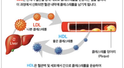 콜레스테롤 이미지