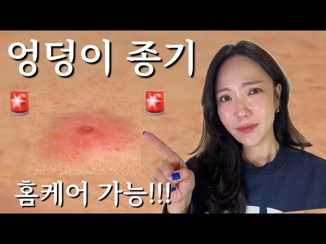 엉덩이 종기가 생기는 이유 왜 생기고 어떻게 관리할까요 완벽 가이드_7