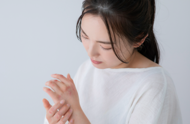 아토피 피부염을 살펴보는 여성