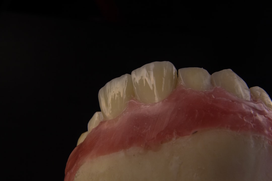 Implant
