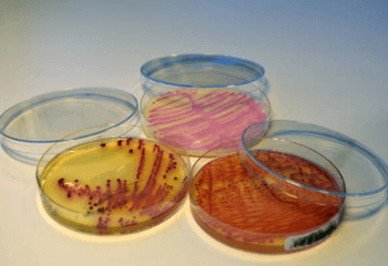 연쇄상구균 독성 쇼크 증후군