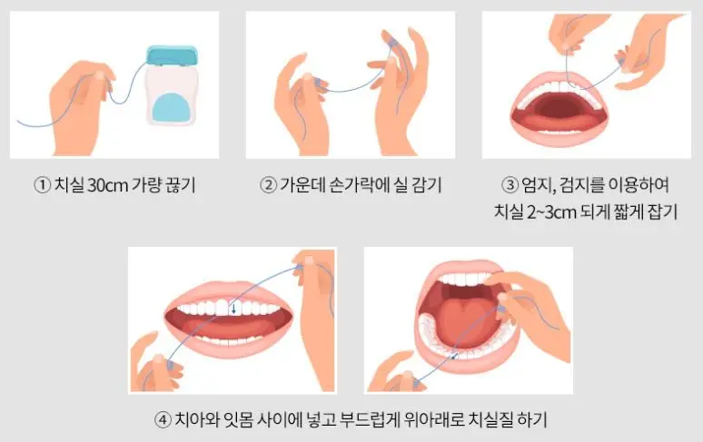 치실-사용법
