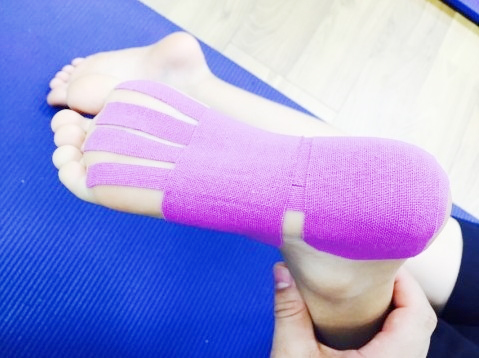 발바닥 통증 부위 진단과 치료