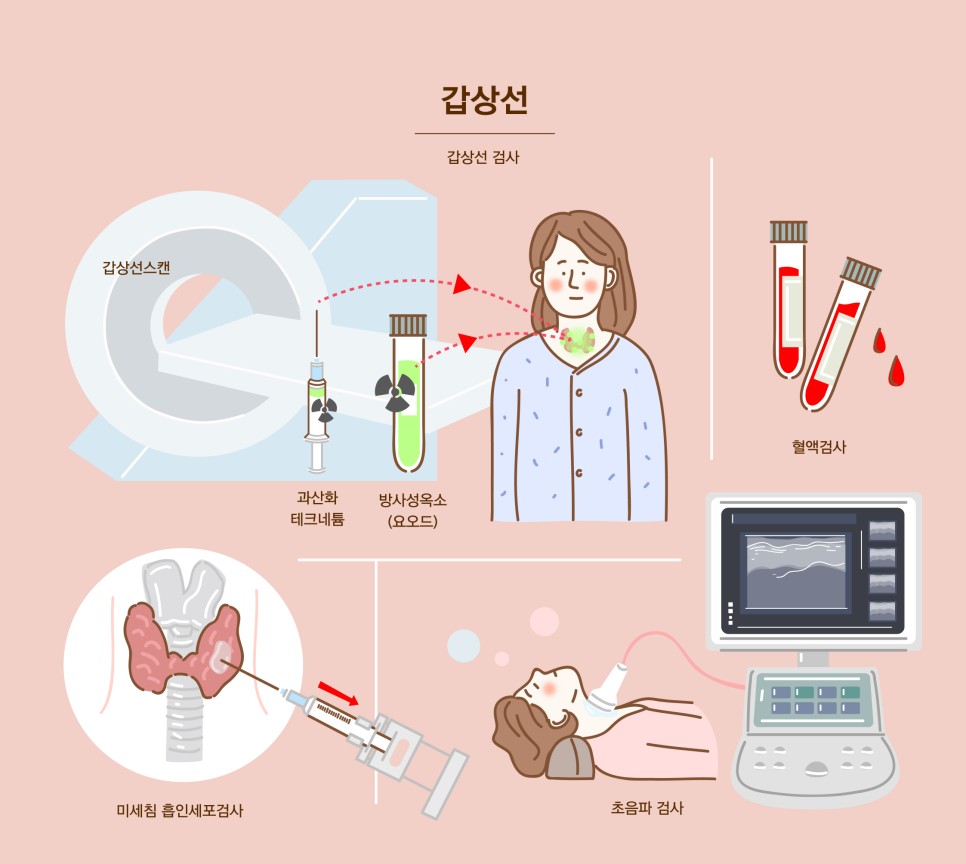 갑상선 결절 증상 및 원인과 치료 기능 저하증 수술 물혹 크기 모양 목에 혹