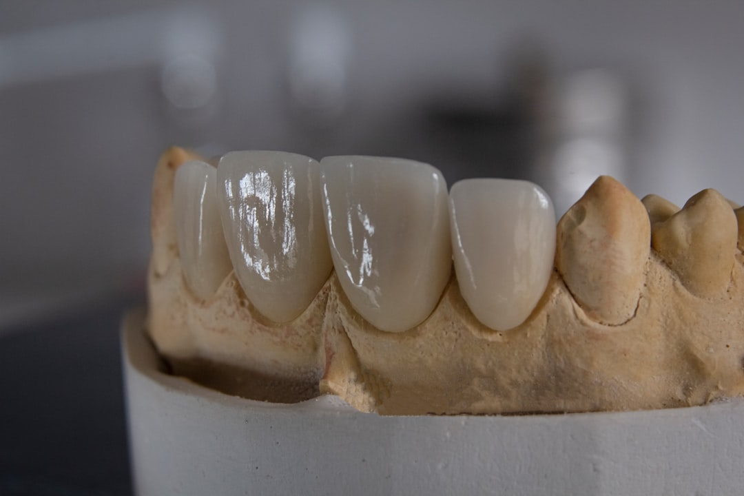 Implant