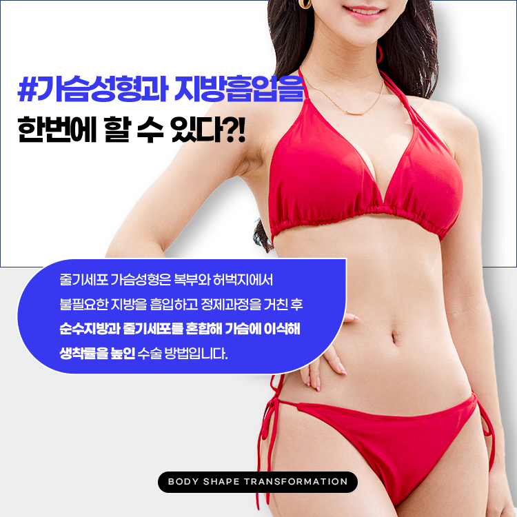 복부와 허벅지에서 불필요한 지방을 흡입하고 정제과정을 거친 후 순수지방과 줄기세포를 혼합해 가슴에 이식해 생착률을 높인 수술 방법입니다.