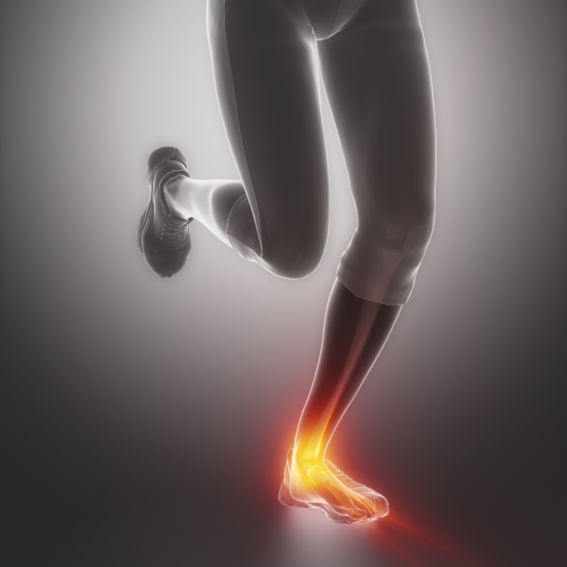 복숭아뼈 아래 통증 붓기 염증