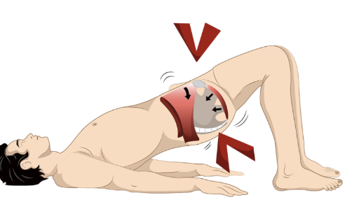 요실금 치료방법 4