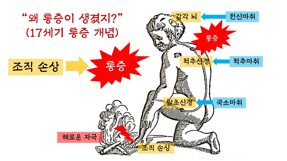 고지혈증 초기증상&amp;#44; 피로로 시작되는 경우가 많은 이유