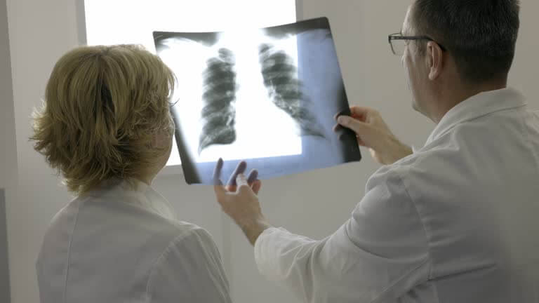 폐암 4기 진단받았다면? 생존율과 최신 치료법 총정리