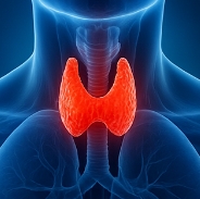 갑상선 기능 항진증