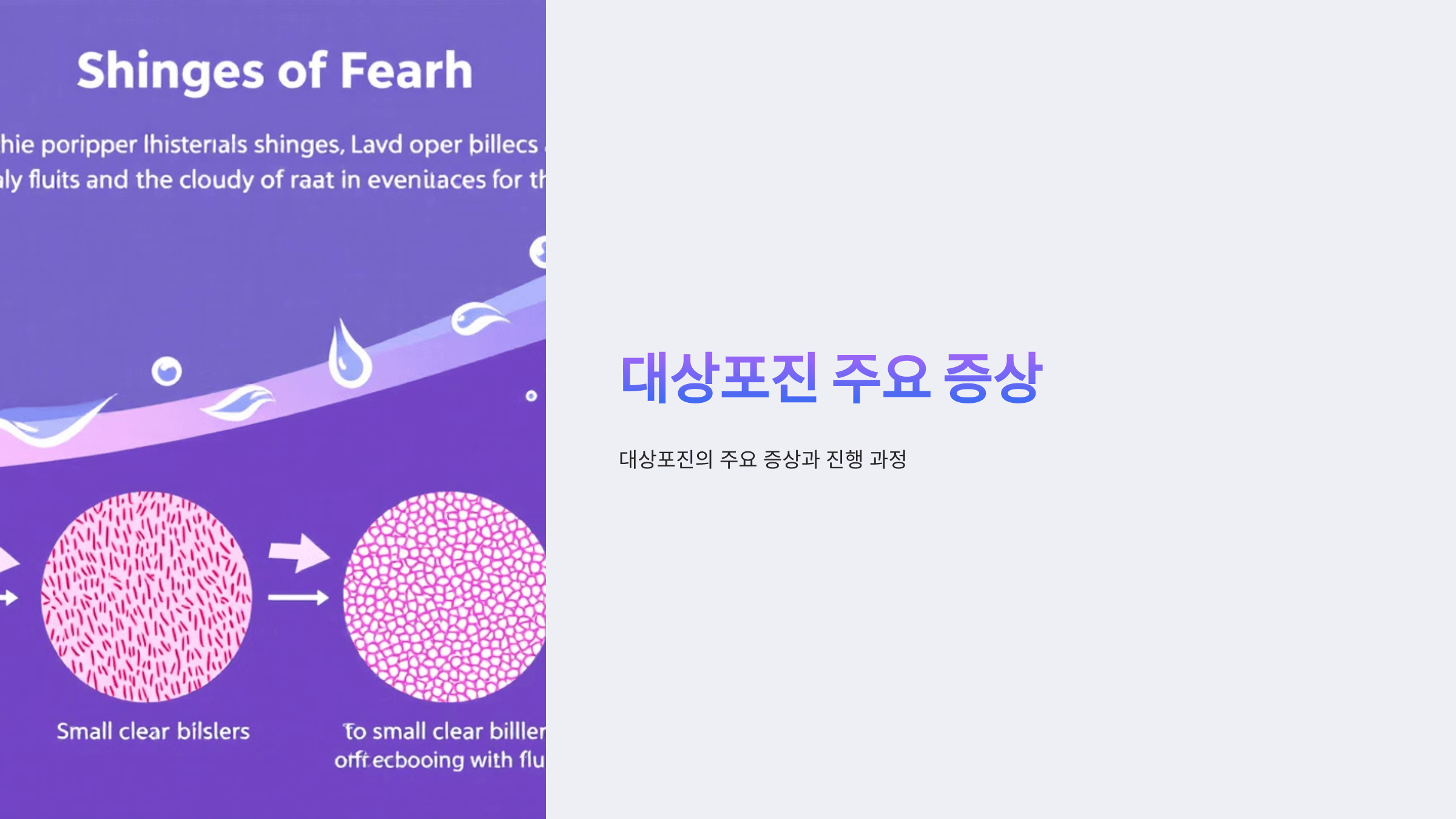 대상포진과 관련된 사진입니다.