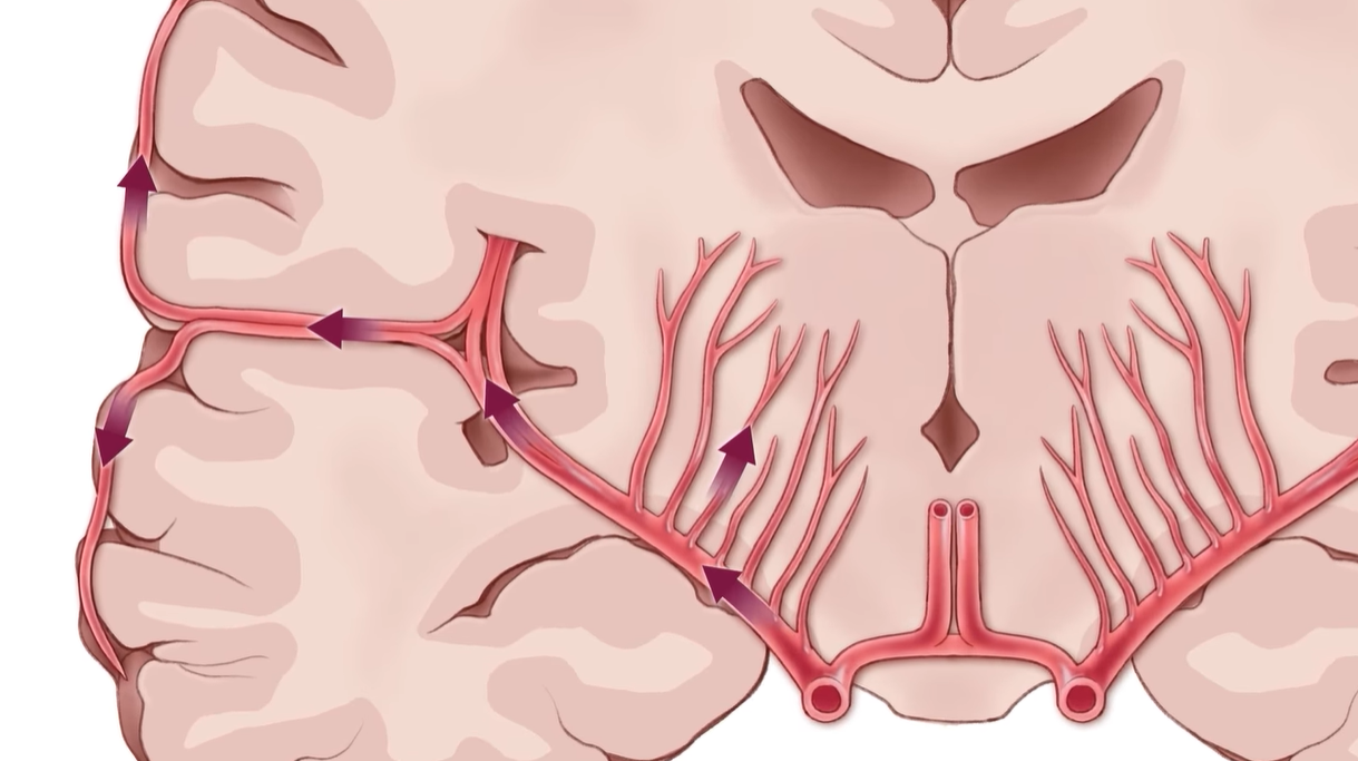 모야모야병 증상
