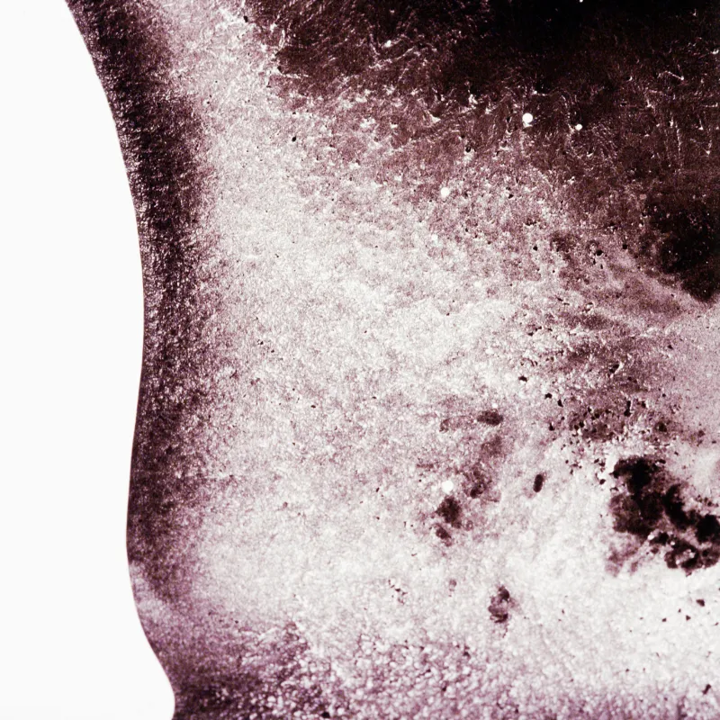 갑상선암 초기증상&amp;#44; 갑상선암 완치사례&amp;#44; 갑상선암 좋은음식&amp;#44; 갑상선암 식단&amp;#44; 갑상선암 연예인&amp;#44; 갑상선암 위험군&amp;#44; 갑상선암 회복기&amp;#44; 갑상선암 생존율&amp;#44; 여성 갑상선암&amp;#44; 갑상선암 수술후 관리&amp;#44; 갑상선암 정기검진&amp;#44; 목 이물감 갑상선암&amp;#44; 갑상선암 전조증상&amp;#44; 갑상선암 예방방법&amp;#44; 갑상선암 증상 사진&amp;#44; 갑상선암 자가진단&amp;#44; 갑상선암 검사비용&amp;#44; 갑상선암 초음파검사&amp;#44; 갑상선암 원인&amp;#44; 갑상선암 혈액검사