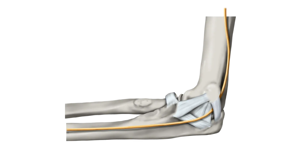 팔꿈치통증 테니스엘보 증상