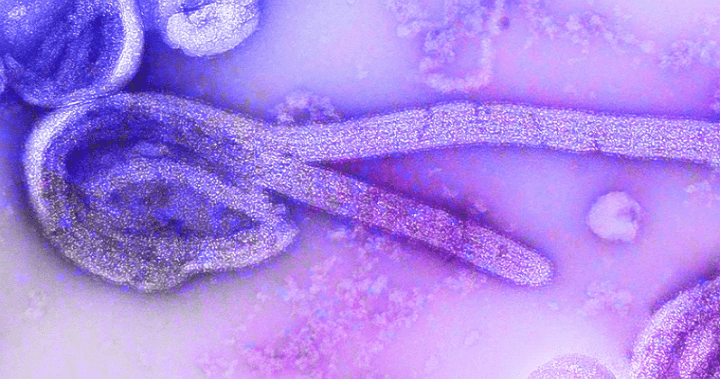활액막염을 유발하는 세균