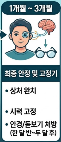 백내장 수술후 시력회복 기간