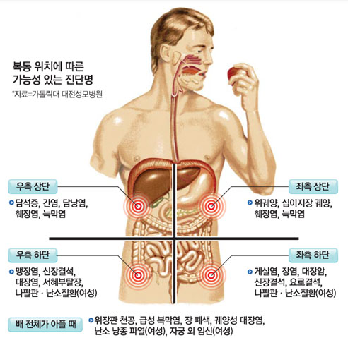 복통 위치에 따른 진단명
출처 : 매일 경제