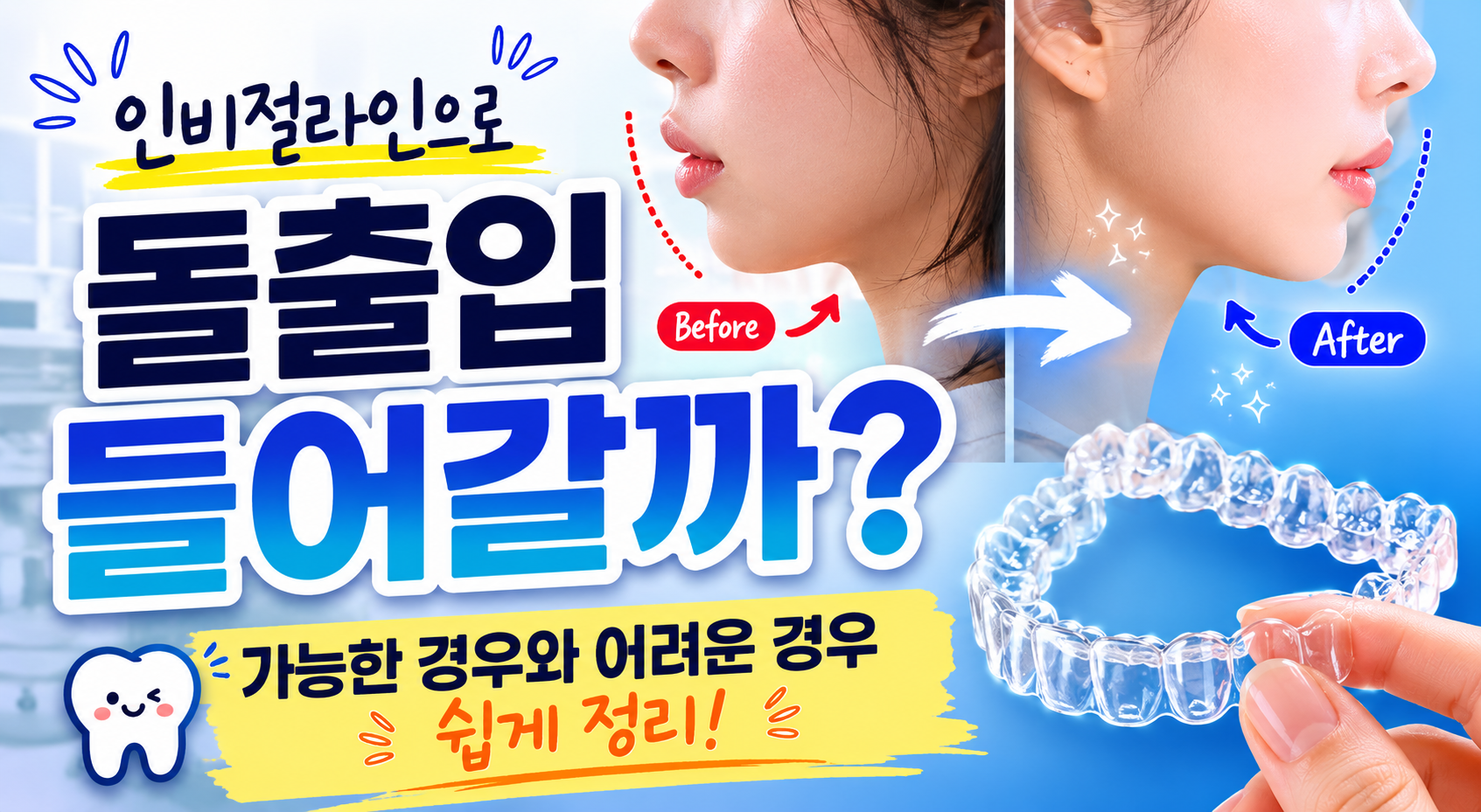 인비절라인으로 돌출입 들어갈까?