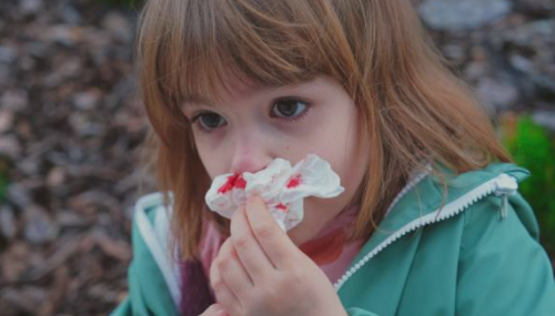 코피 자주 나는 이유 멈추는 법