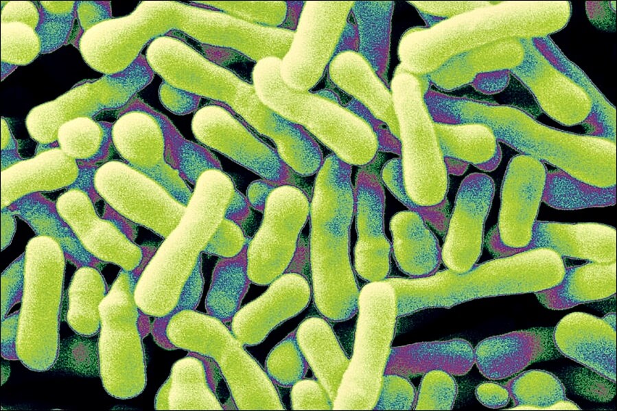 LGG 유산균 추천제품 및 효능