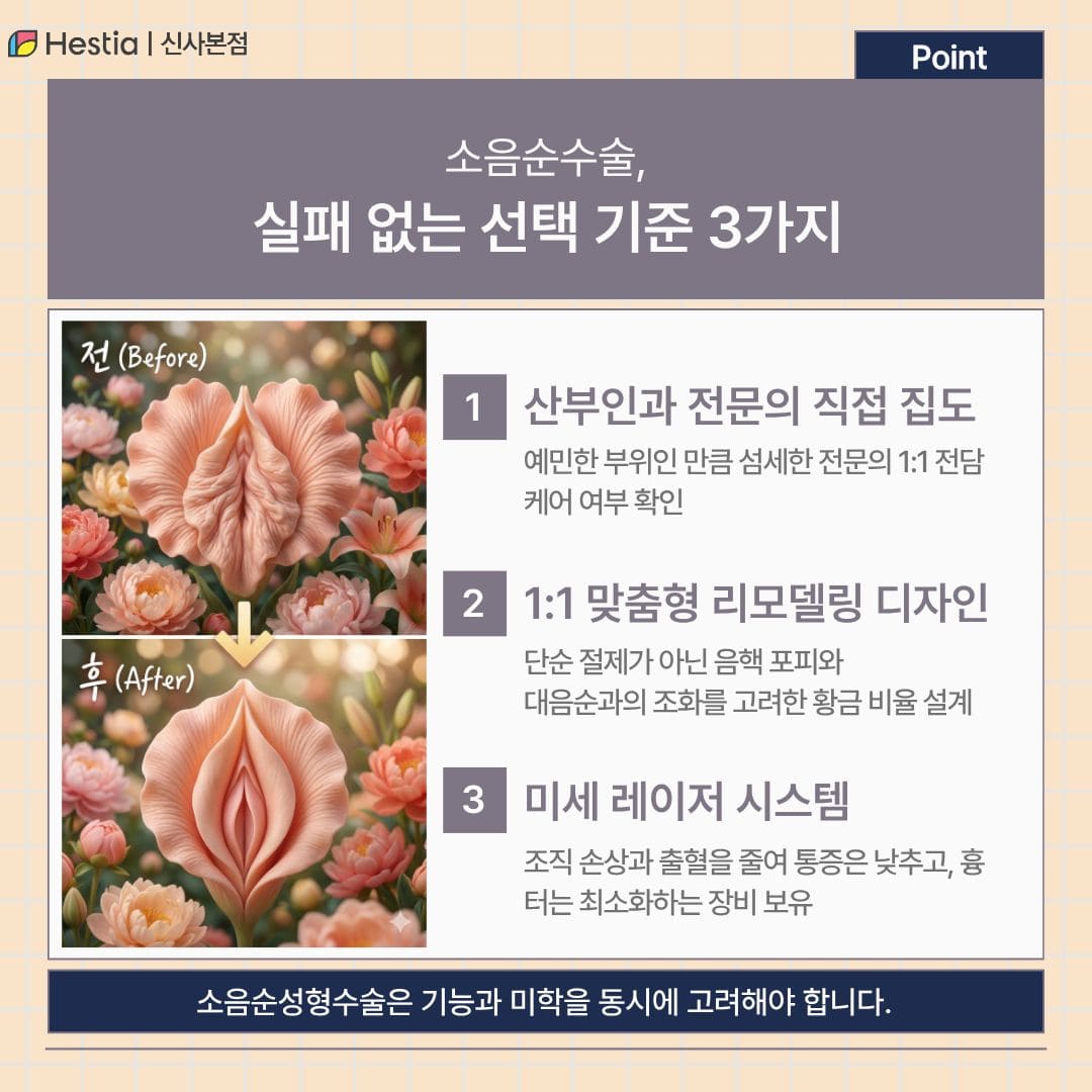 소음순수술, 병원 선택의 기준은?