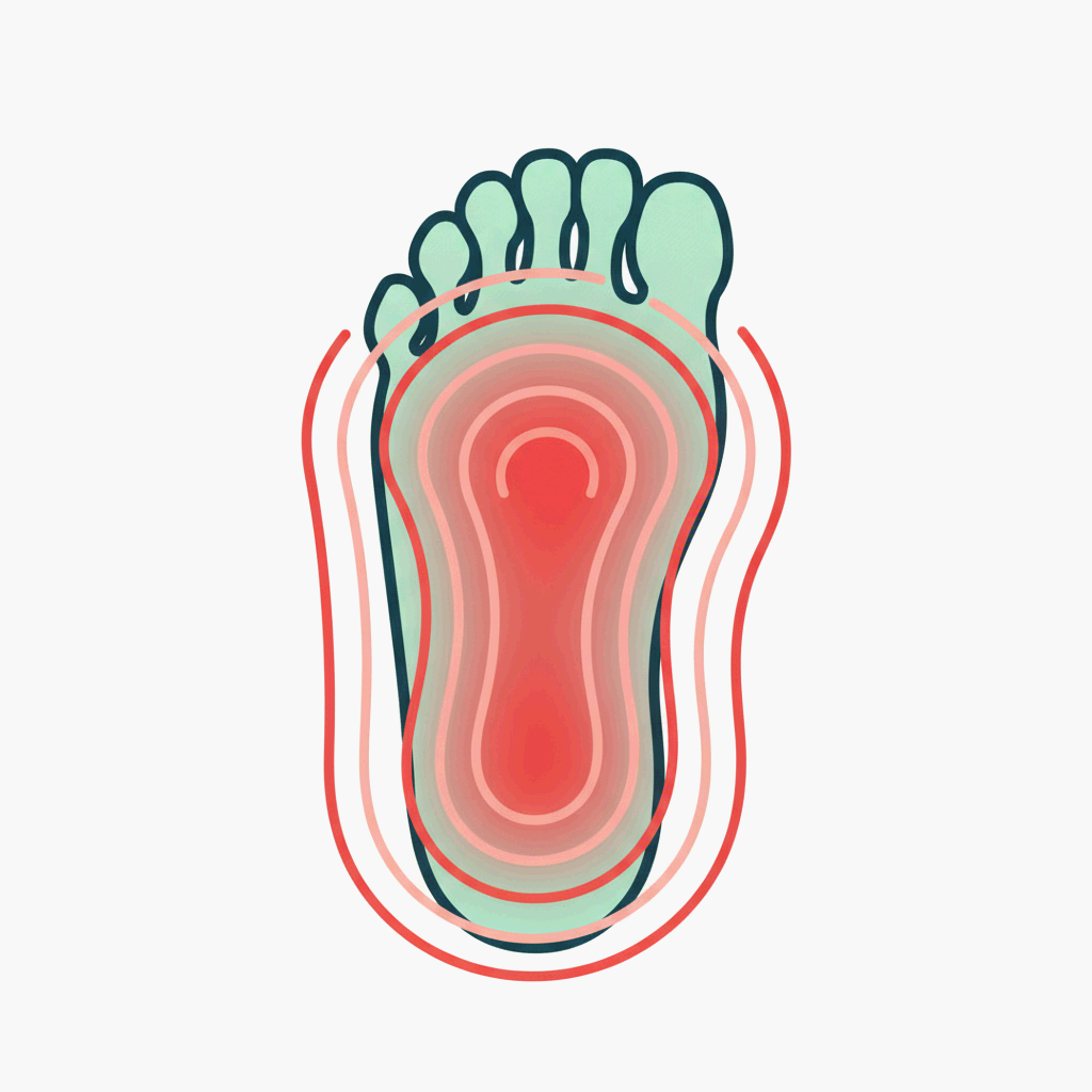 발바닥이 뜨거워지는 현상을 상징적으로 표현한 발바닥 일러스트레이션