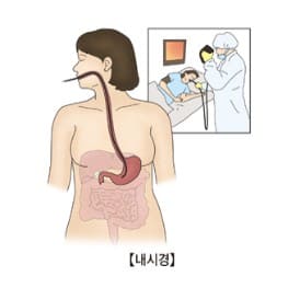 위암&amp;#44; 위암 초기증상&amp;#44; 위암에 좋은 음식&amp;#44; 위암 3기 생존율&amp;#44; 위암 4기 생존율&amp;#44; 위암 수술후 회복기간&amp;#44; 위암 수술후 먹지말아야 할 음식&amp;#44; 위암수술후 좋은 음식&amp;#44; 위암 2기 생존율&amp;#44; 위암 증상 잦은 방귀