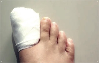 발가락 실금: 원인, 증상, 그리고 치료법