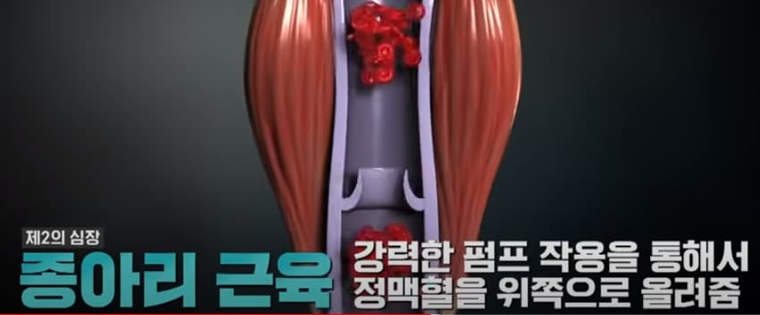 하지정맥류-운동