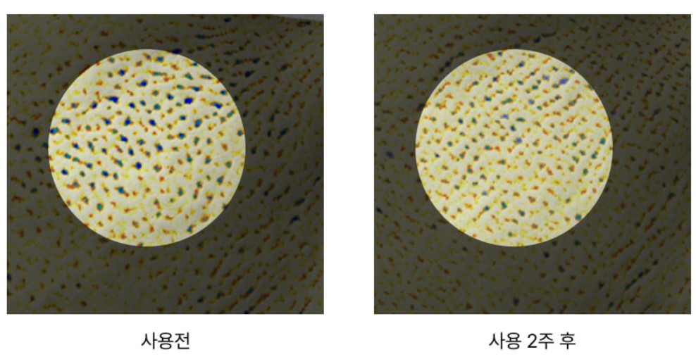 모공개선 인체적용시험결과 모공 사진