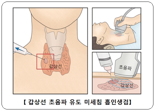 출처:서울아산병원