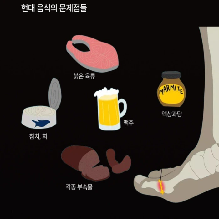 셀로비스 요사민 내돈내산 후기 효능 성분 부작용 복용법 가격 통풍 효과