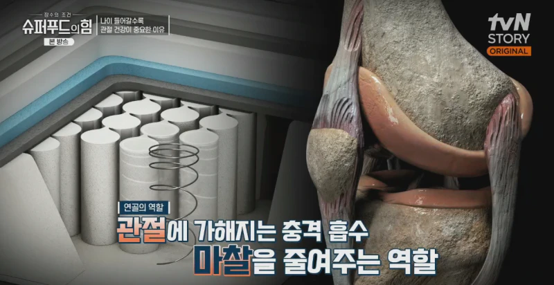 관절염