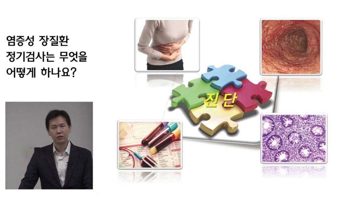 EBS명의-장질환-명의-천재영-교수