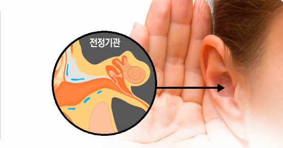 전정신경염