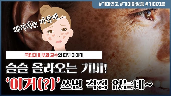 기미 없애는 방법