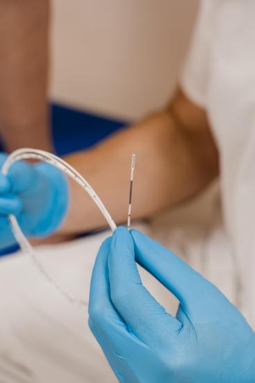 레이저 치료(EVLT, Endovenous Laser Therapy) &ndash; 중등도 하지정맥류 치료