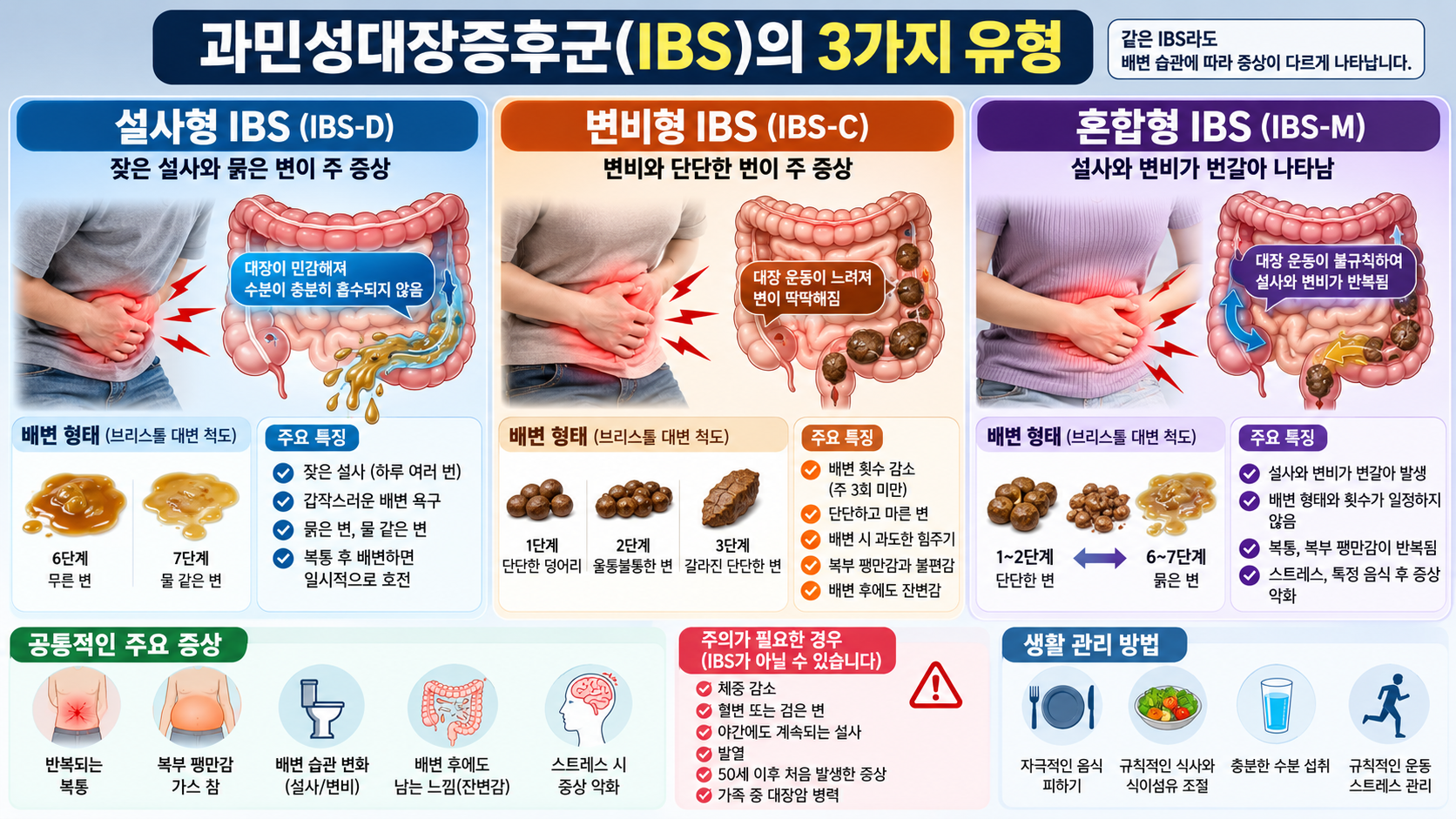과민성 대장증후군 설사형 변비형 혼합형 비교