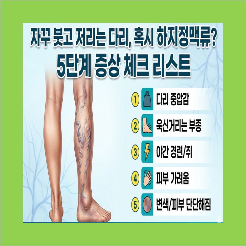 하지정맥류 원인, 증상, 치료법, 예방 수칙 썸네일 이미지