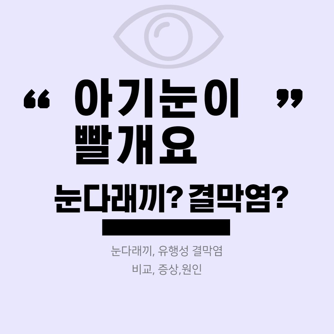 아기-눈이-빨개요-눈다래끼-유행성-결막염-비교-증상-원인