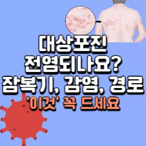 대상포진-전염성
대상포진-전염되나요
대상포진-잠복기
대상포진-감염